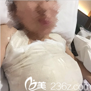 像男人一样平的胸终于在张东旭的假体丰胸术后挺起来了