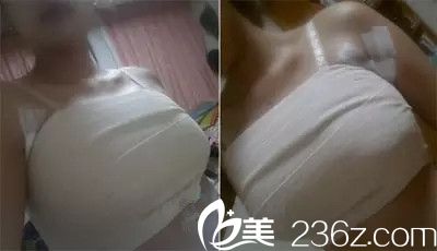 做手术可以穿内衣嘛_美女只穿内衣(3)