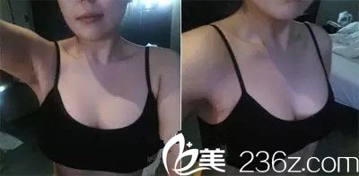 做全麻手术穿内衣吗_美女只穿内衣(2)