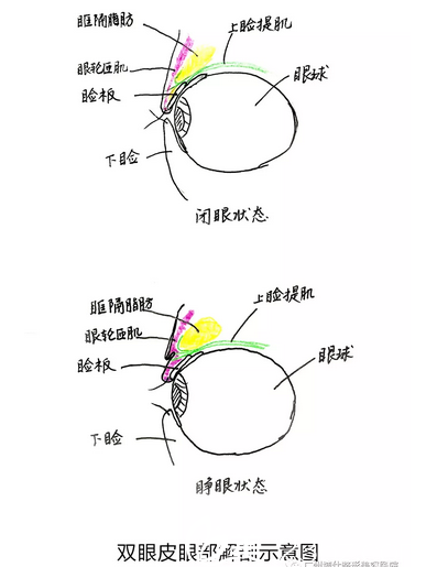 广州博仕仿生理双眼皮多少钱张建军给出仿生双眼皮及