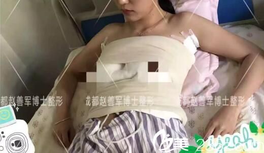 赵医生根据这位妹子的胸部基础情况,为她选择了假体隆胸手术方式,并