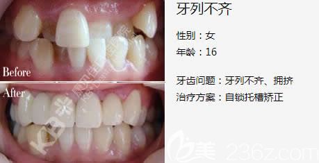 章丘私人口腔_章丘大葱(2)