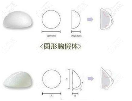 美国曼托水滴形和圆形假体隆胸价格一样吗?乳房轻度下垂选哪种形状