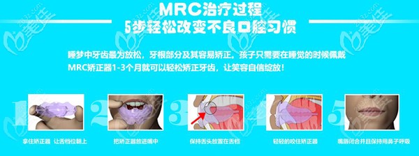 从mrc牙齿矫正器的利弊来分析为什么儿童mrc矫正器争议大,还有人说是