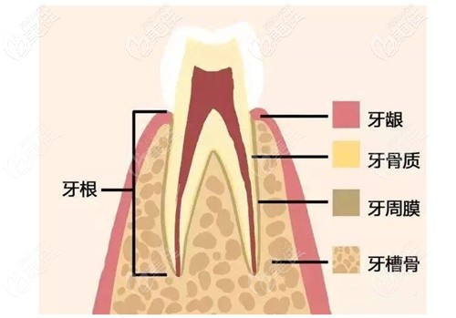 首先我们先来了解下牙槽骨吸收是什么意思?