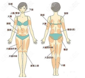 吸脂瘦大腿 _ 美佳网整形问答