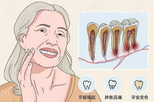 牙根尖虽然有囊肿但不疼可以不管吗?不治疗的后果是啥