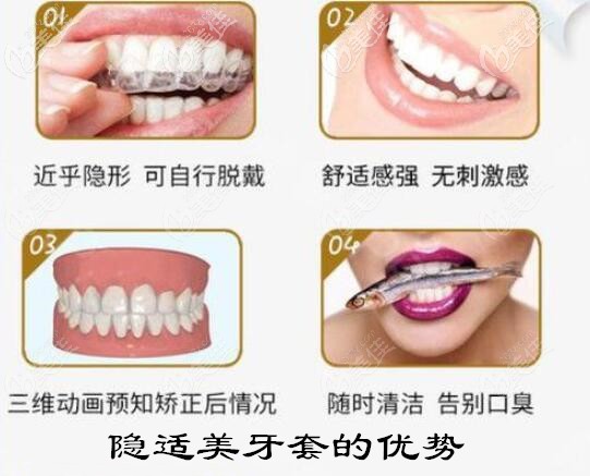 虎牙拥挤排列不齐我35岁时戴隐适美透明牙套矫正了两年