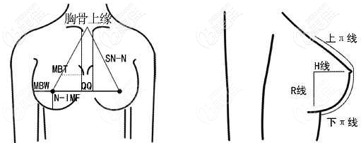 乳房上提术有哪些风险假体植入和脂肪植入哪个效果好