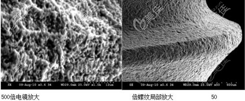 瑞士astra种植体怎么样各种愈合基台型号让你眼花缭乱