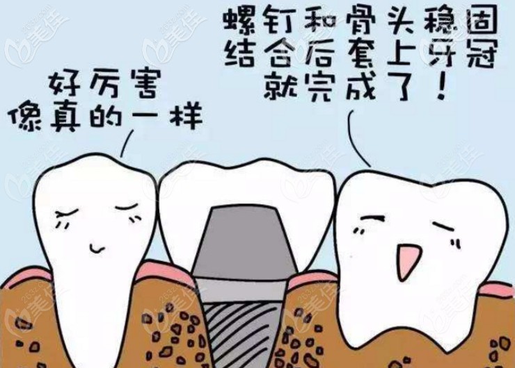 微创即刻种植牙和普通种植牙哪个好?其区别在于它们的