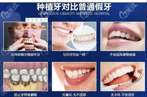 乐山英美牙科种植牙收费贵吗?其实它是医保定点整牙价格还算便宜!