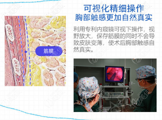 网友说夏文豪医生做内窥镜隆胸技术挺好那价格会不会很贵