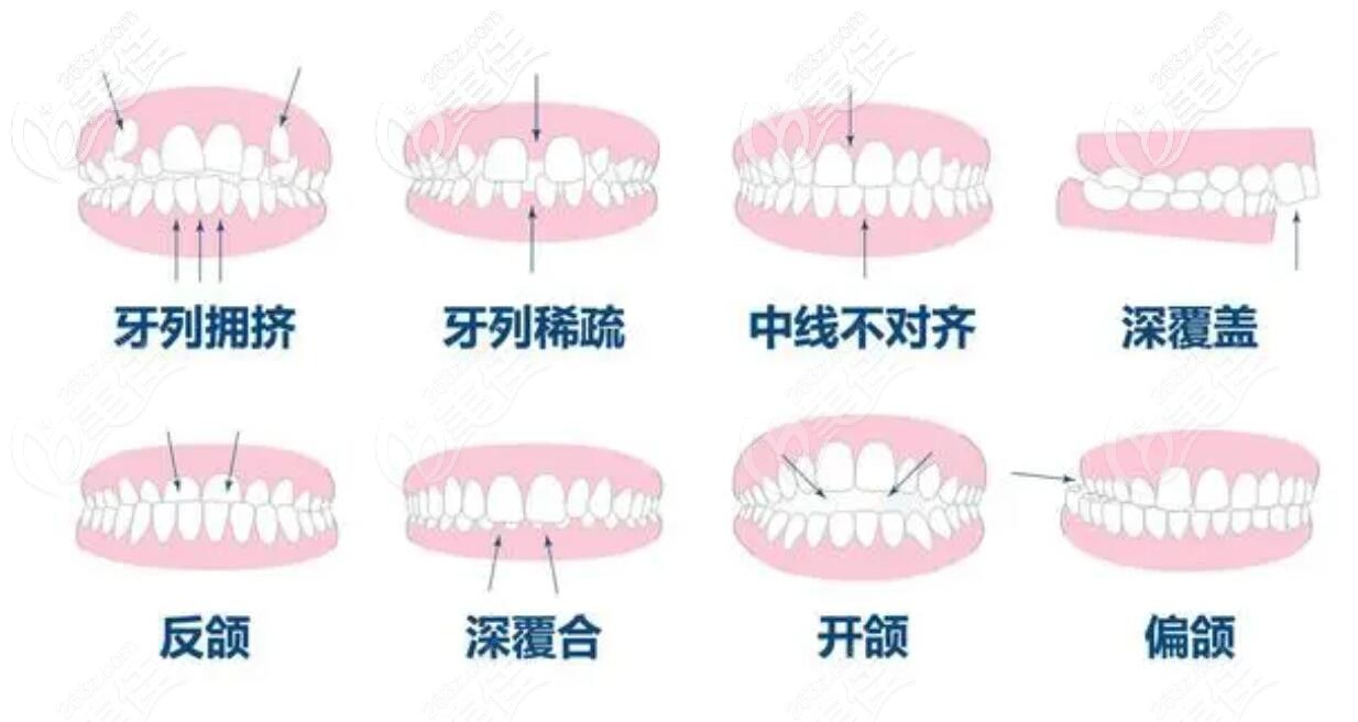 牙齿不齐的危害