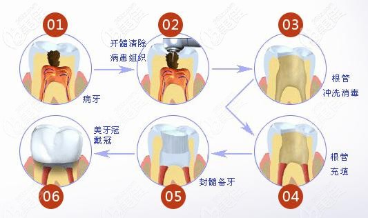 这有重庆牙科医院收费价目表,拔牙,补牙,根管治疗多少