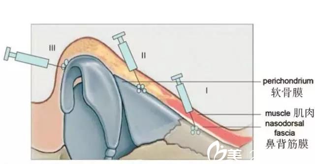 星架玻人口(2)