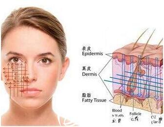 西安美莱医学美容医院蛋白线原理