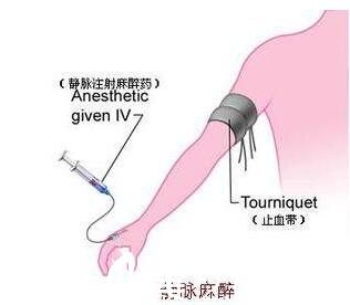 韩国iWell爱我整形外科医院静脉麻醉