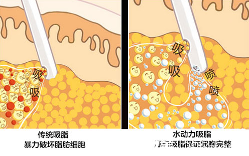 韩国贝缇莱茵整形医院金懿宗医生2