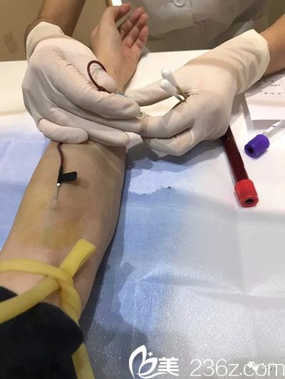 抽血检查