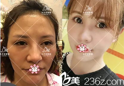 <!--<i data=20240703-sp></i>-->美整形美容门诊部怎么样