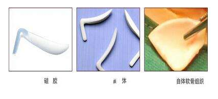 假体隆鼻的三种材料