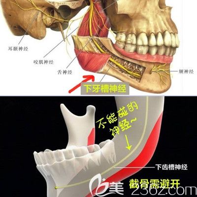 做完下颌角手术会损伤面部神经导致嘴歪吗?