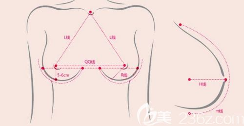 韩国必妩假体隆胸手术美学