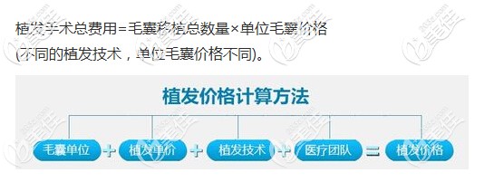 植发手术价格计算方式
