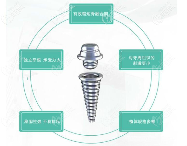 韩国美格真种植体优势