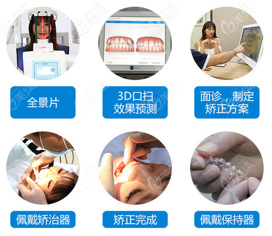 invisalign牙套多少钱元旦来广州壹加壹口腔invisalign隐形牙套价格32