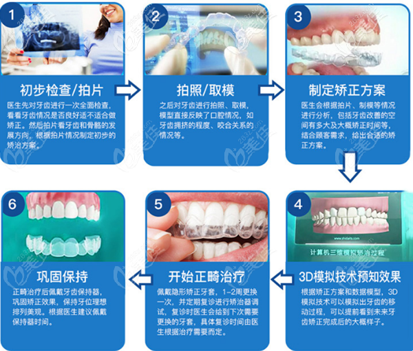 郑州美奥牙齿正畸过程