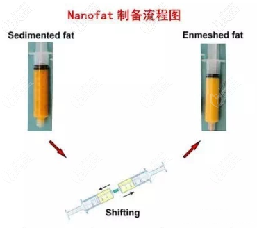 纳米脂肪的制备过程