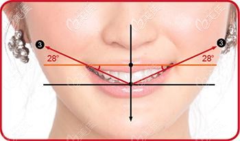 口腔微笑曲线图片