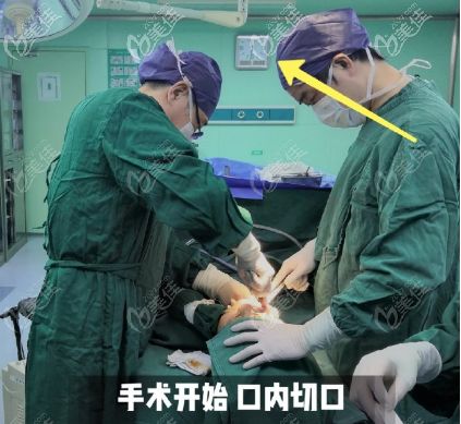 上海李志海医生做颌面手术靠谱吗?他的磨骨风格是什么样子_最热整形行