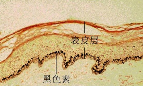 光学显微镜下观察的皮肤切片图紫外线是引发皮肤变黑的主要元凶